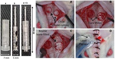 Optimal Parameters of Laser Therapy to Improve Critical Calvarial Defects